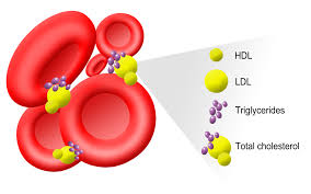 bad cholesterol blood test