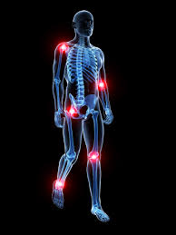 Pain relief